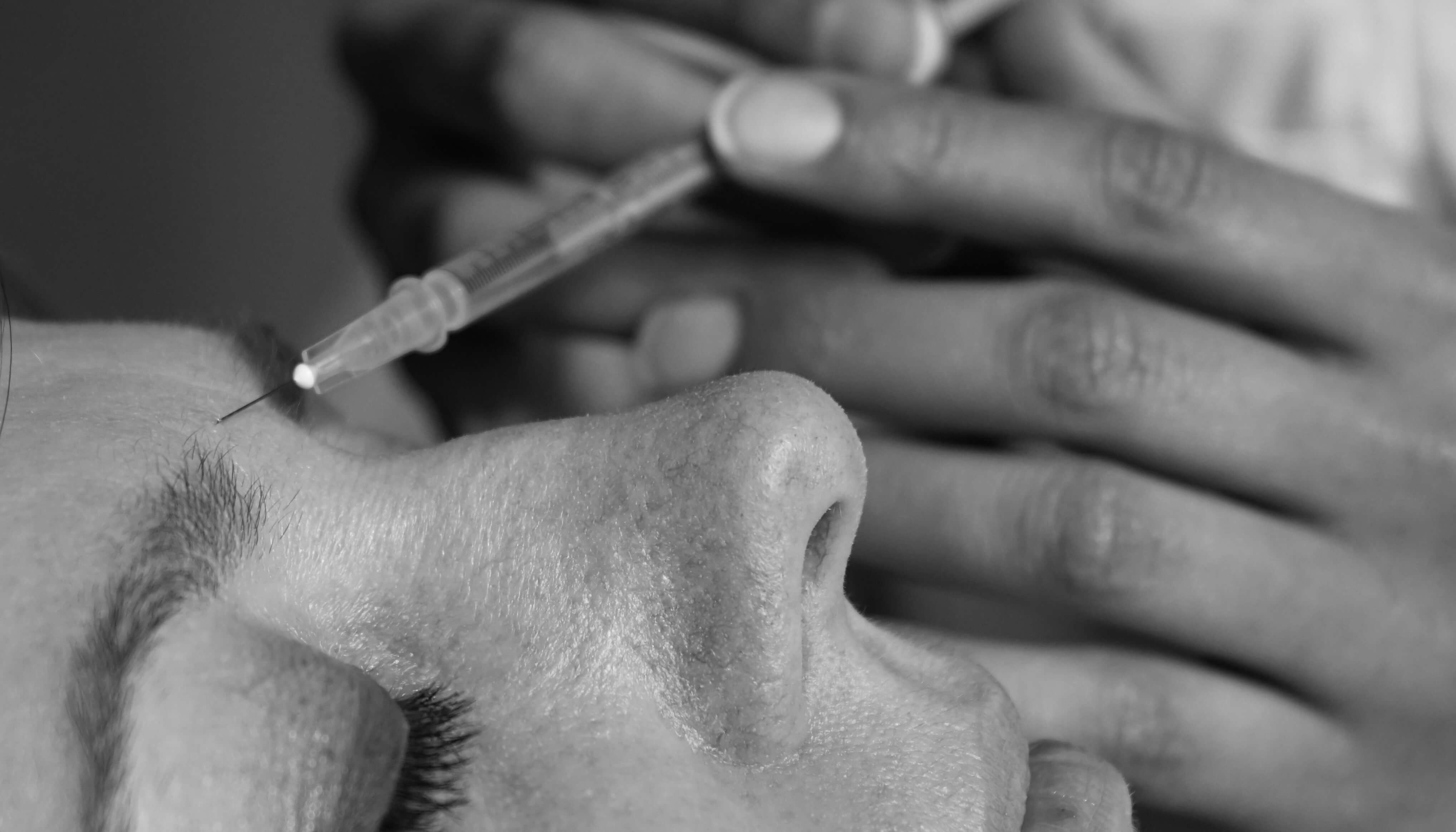 How Does Botox Help Prevent Migraine?