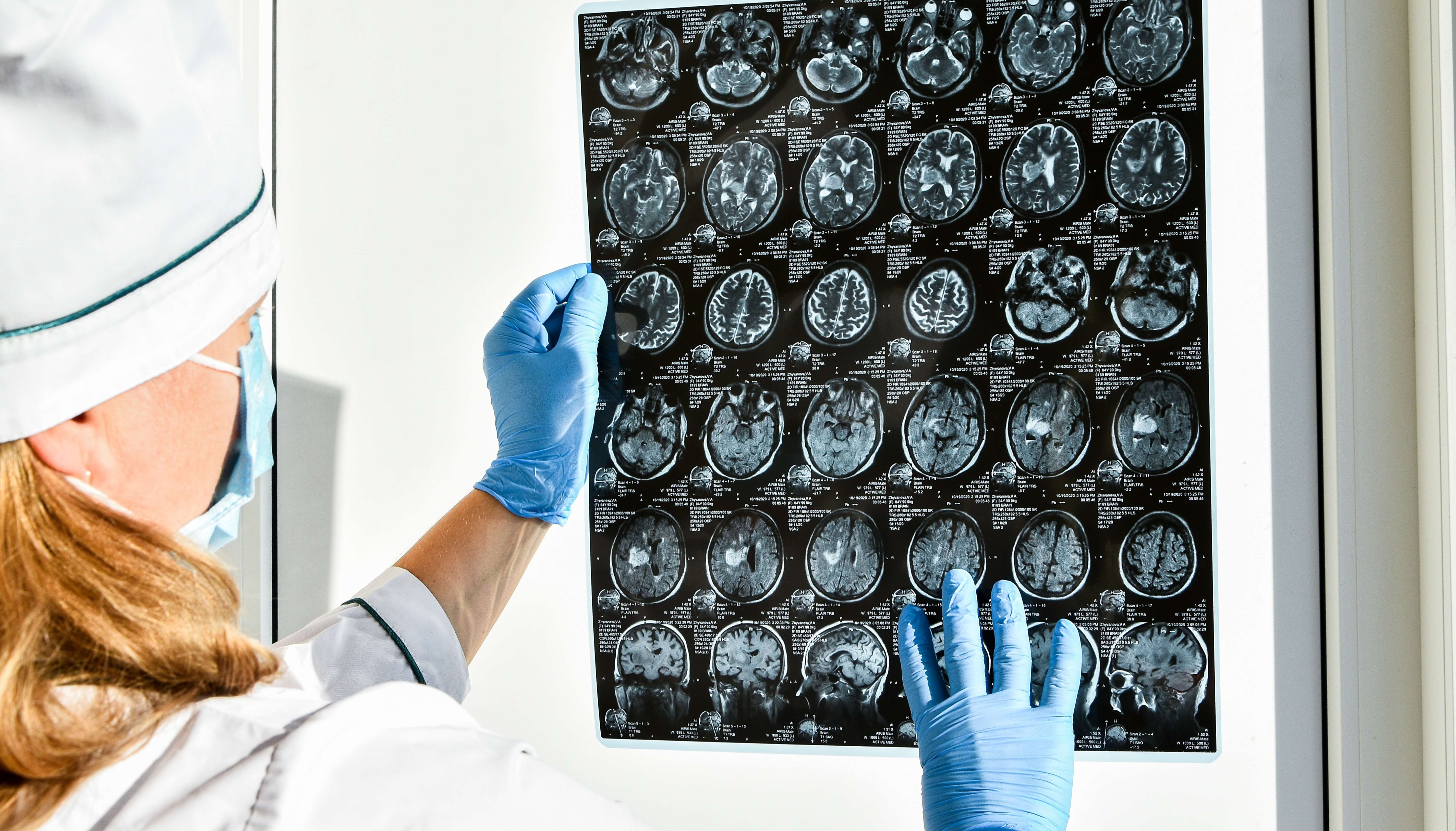 Is My Headache Caused by Something More Concerning?