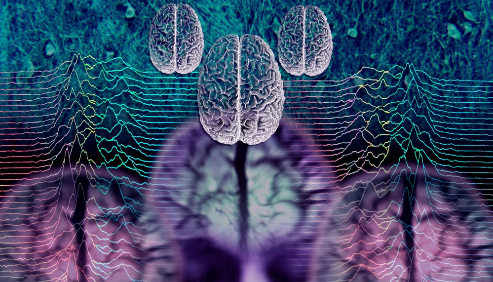 Recap of The American Headache Society 2022 Scientific Meeting